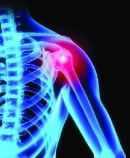 Shoulder Pain